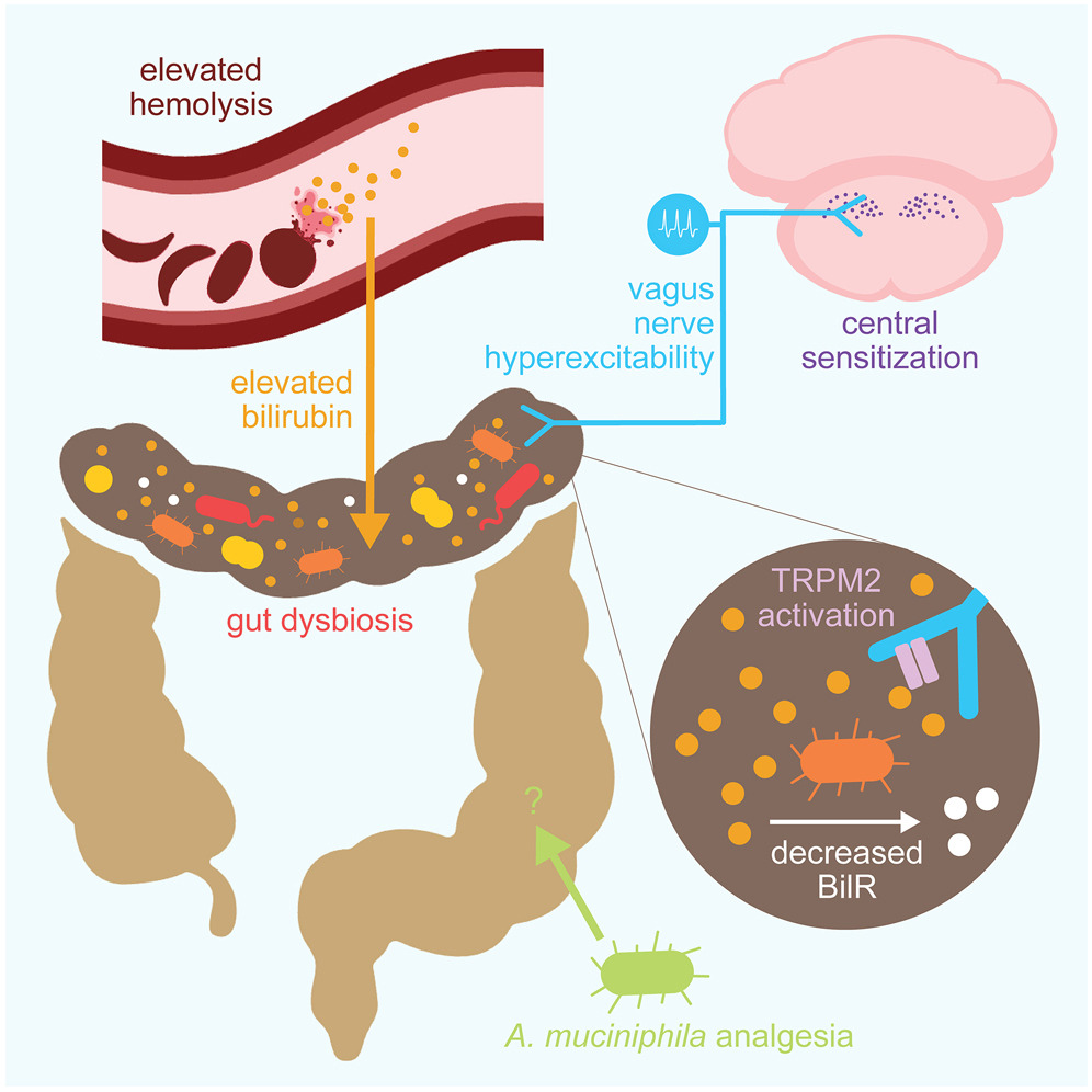 Understanding the Link Between Chronic Sickle Cell Pain and Gut Microbial Imbalance